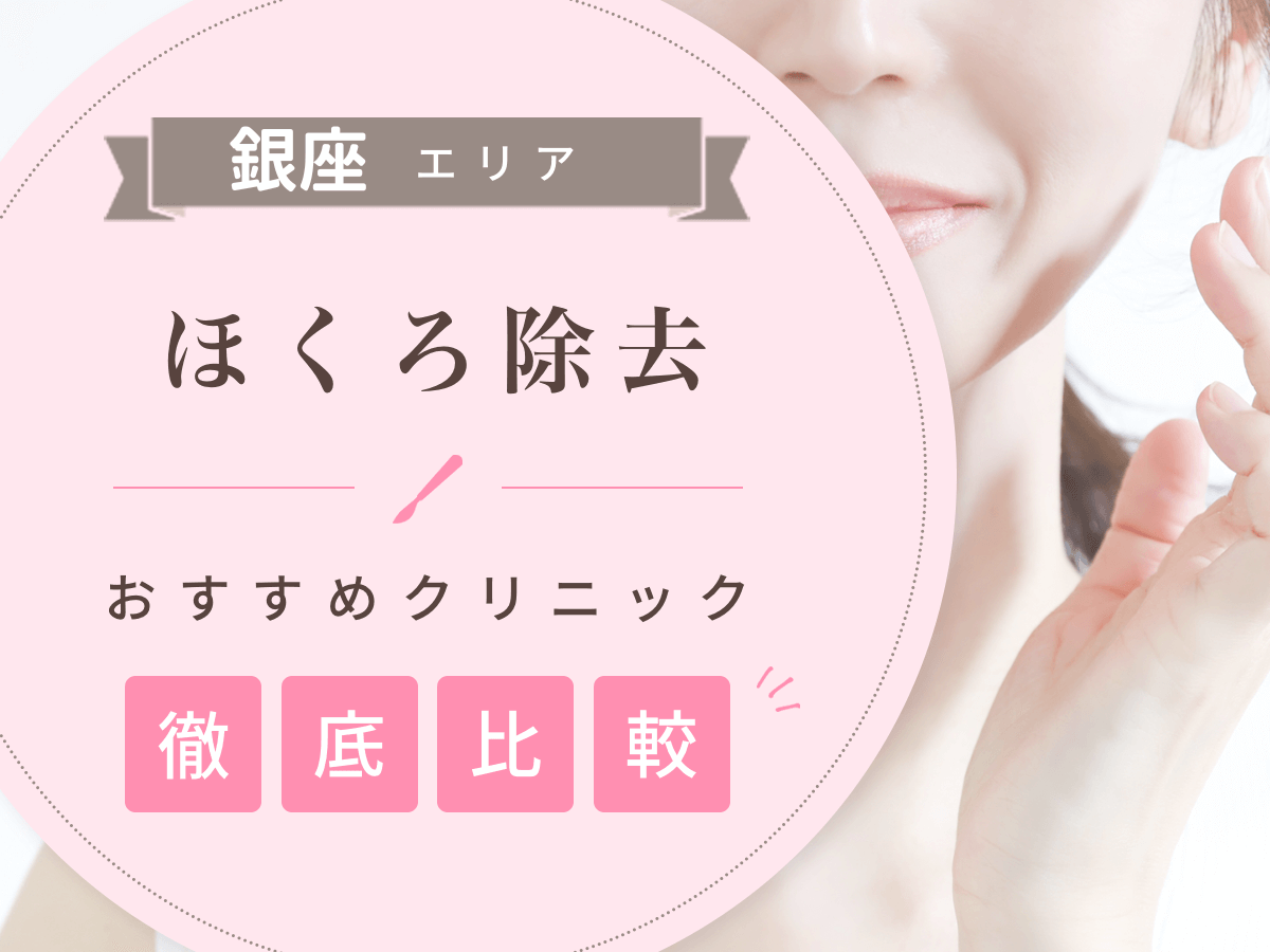 銀座でほくろ除去がおすすめな値段の安いクリニックは？後悔しないために評判のいい病院を選ぶコツ